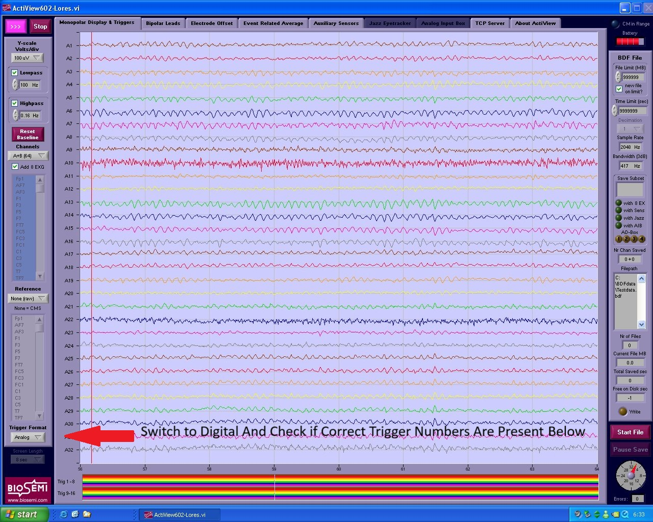 Connecting the electrodes