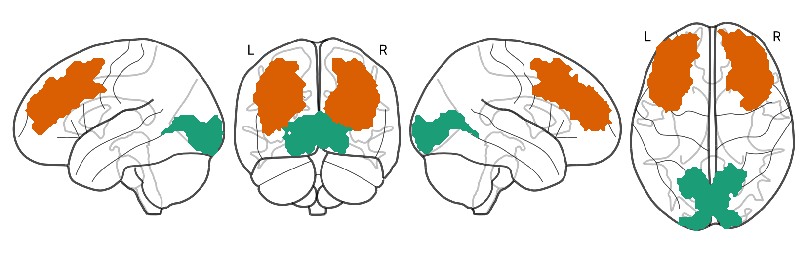 V1 (green) and DLPFC (orange) on a glass brain, seen from the left, front, right and top
